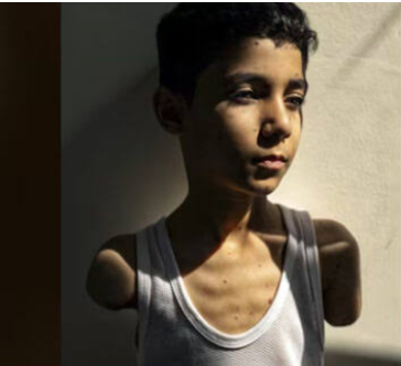 بازوں  سے محروم ہونے والے فلسطینی بچے کی تصویر فوٹو آف دی اٸیر