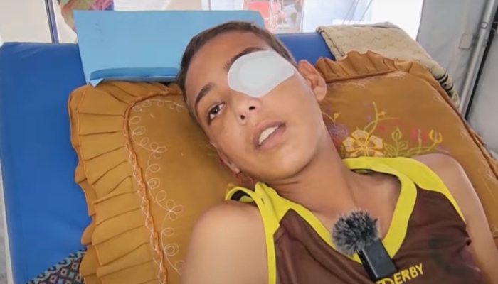 اسرائیلی فوج نے فلسطینی لڑکے کی آنکھ میں گولی مار دی