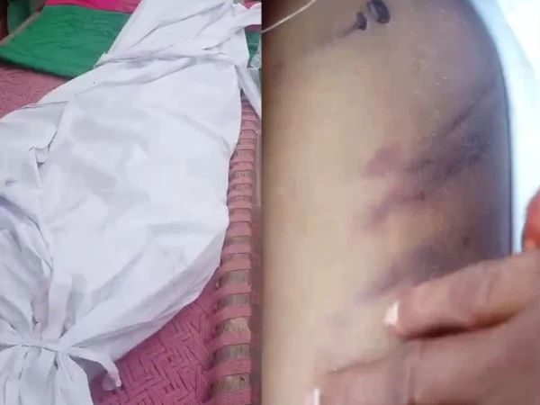 راولپنڈی؛ خاوند کے مبینہ تشدد سے اہلیہ کی ہلاکت، خاموشی سے تدفین کی کوشش ناکام